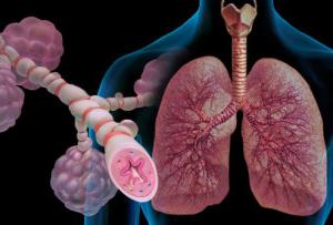 تصنيف فشل الجهاز التنفسي حسب النوع، المرضية، العوامل إتيوباثوجينيتيك